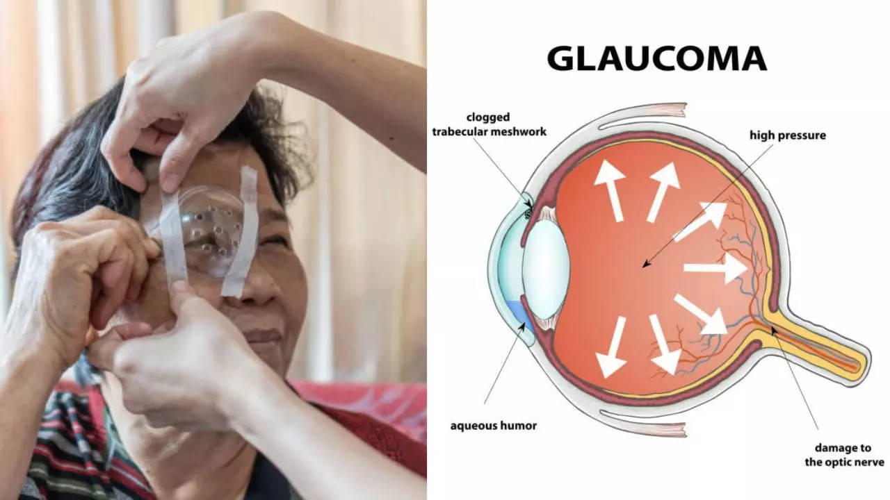 How Does High Blood Sugar Levels Put You At Dangerous Risk Of Glaucoma