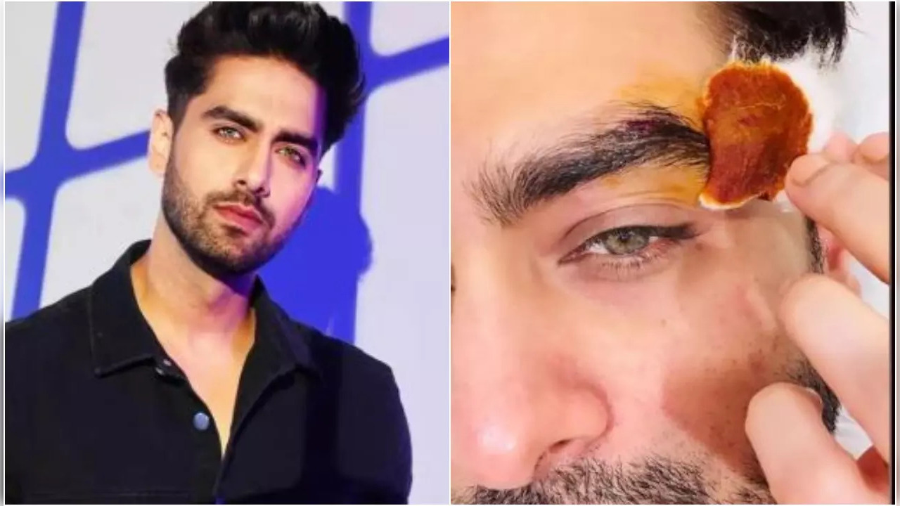 Yeh Rishta Kya Kehlata Hai Actor Rohit Purohit Suffers Eye Injury