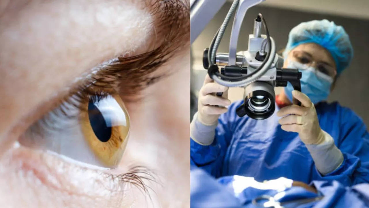 Can Corneal Transplants Really Restore Perfect Vision? Myths VS. Facts Revealed!