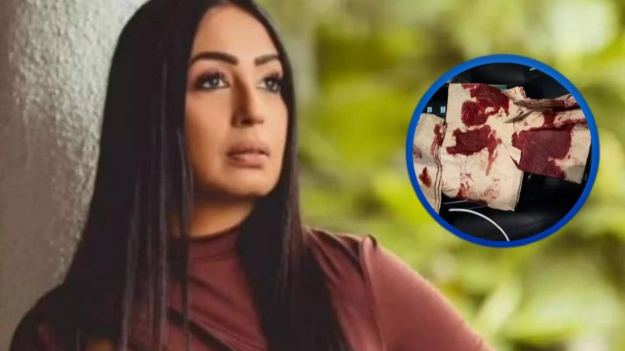 Kashmera Shah Meets With 'Freak Accident', Shares Photos Of Blood-Soaked Tissues