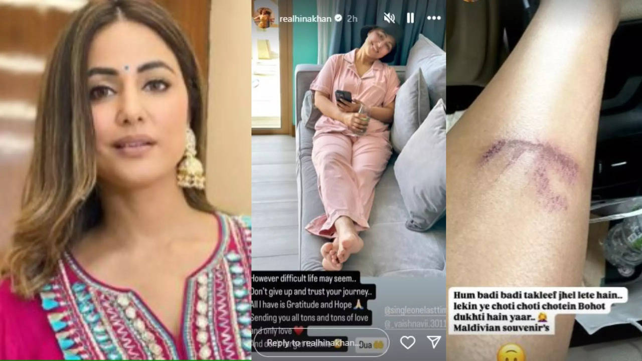 Hina Khan Injures Leg On Vacation, Shares Emotional Post