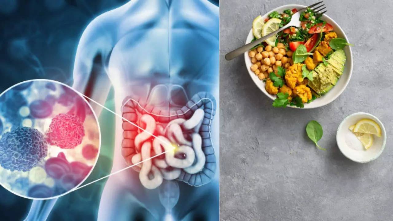 Healthiest Foods To Prevent Colorectal Cancer In Gen Z 