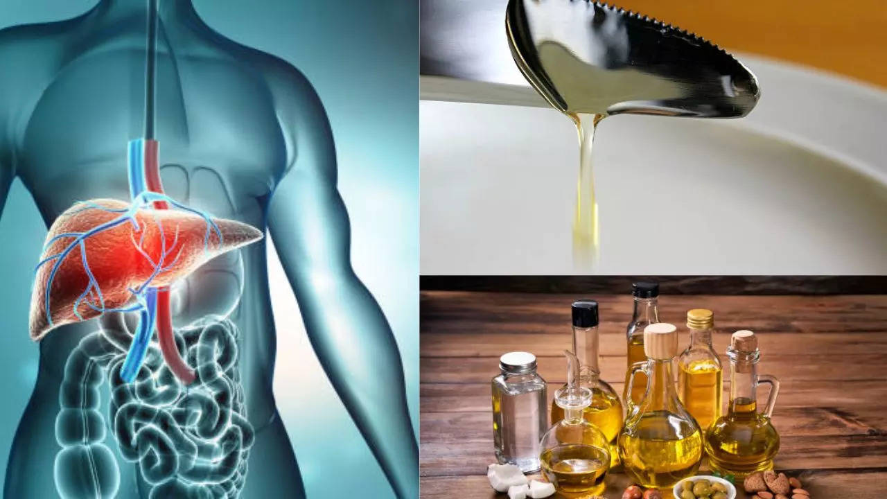 Corn syrup and seed oils are the most dangerous foods for your liver health