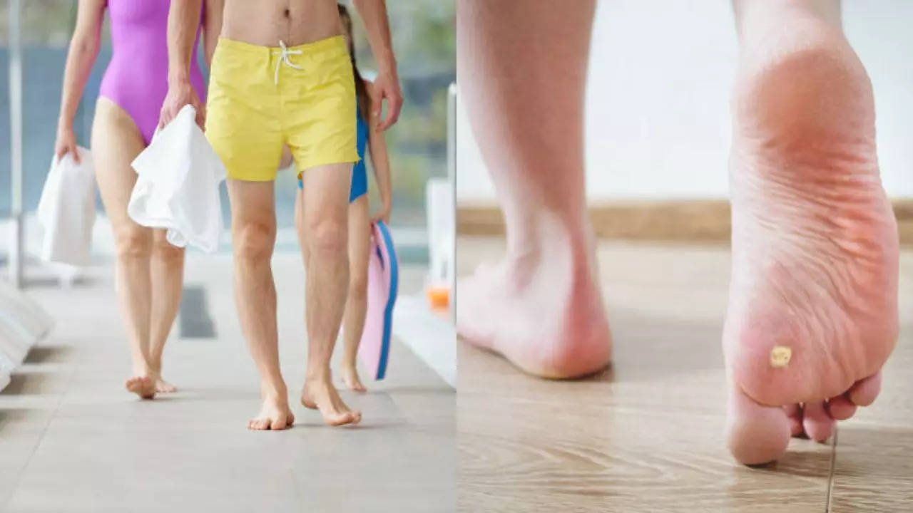 Can Walking Barefoot Give You HPV, Cancer