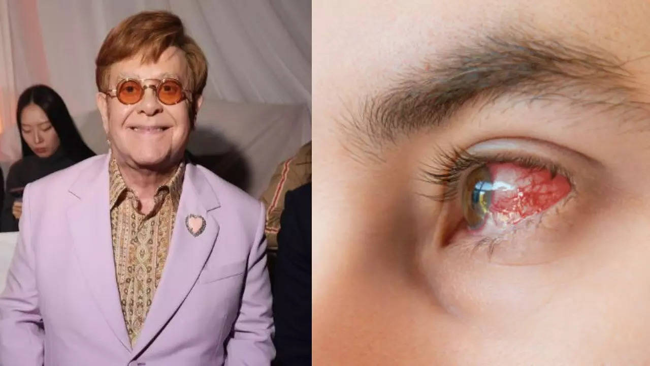 Elton John Says He Is Blind In The Right Eye Due to an Infection