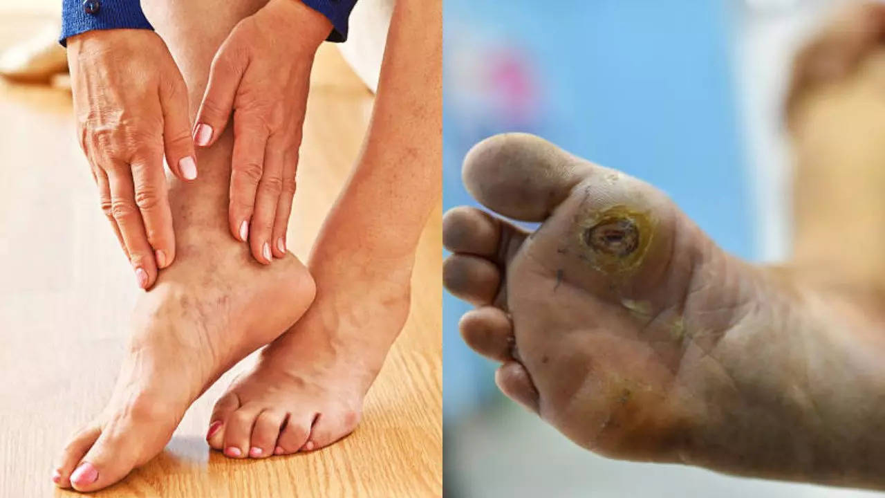 Warning Signs Your Feet Show For Common Deficiencies and Conditions