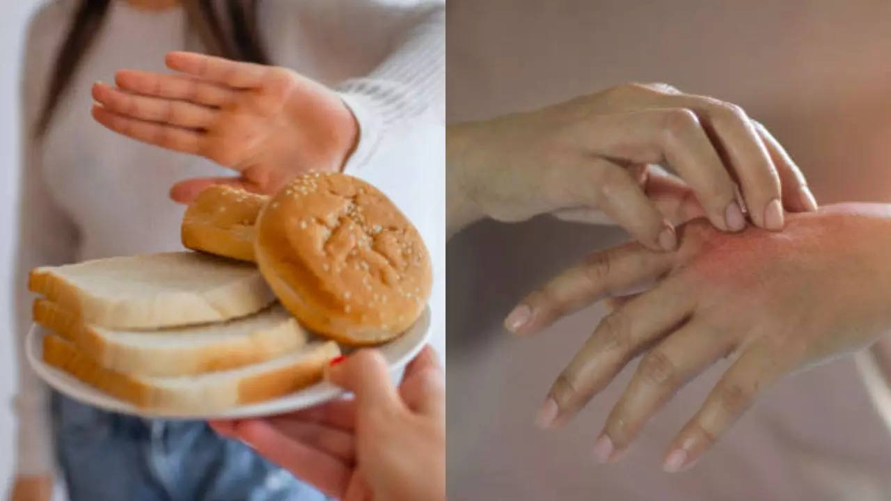 Wheat Allergy Warning: These 7 Subtle Signs Could Be Affecting You