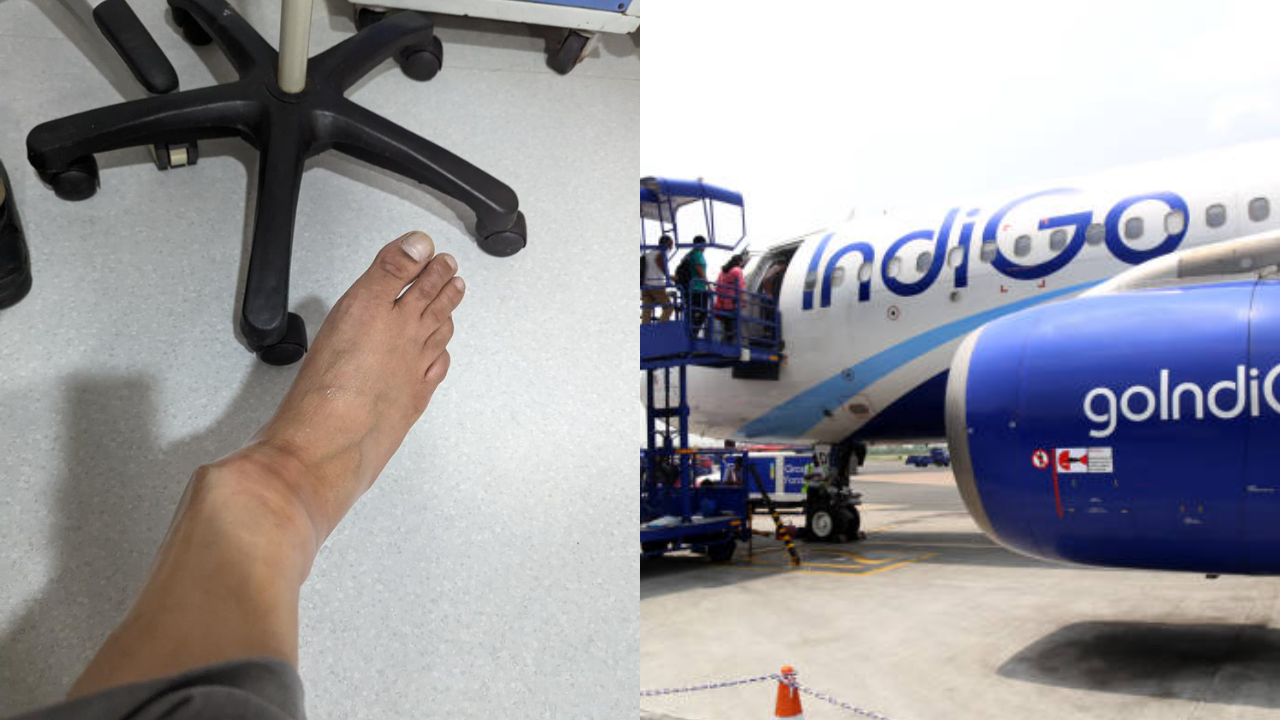 IndiGo Shares Statement on Passenger’s Injury Explains Ramp Condition and Response