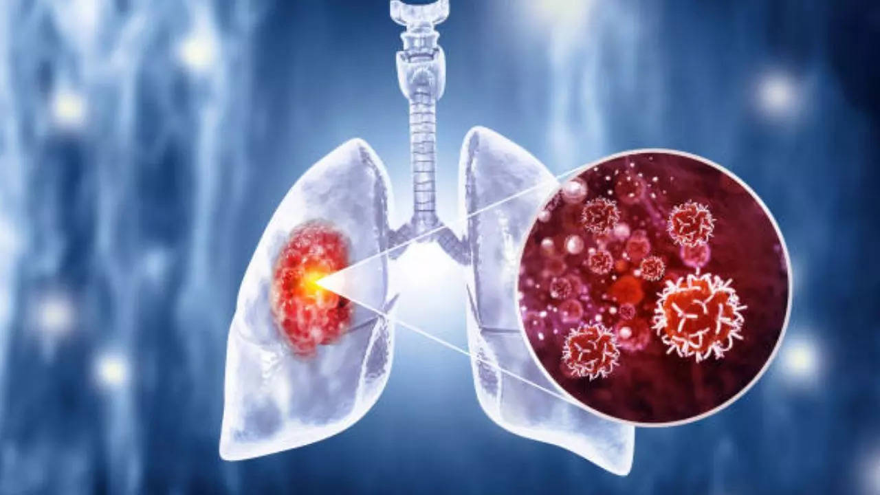 World’s First Urine Test Promises To Spot Lung Cancer Before It’s Too Late