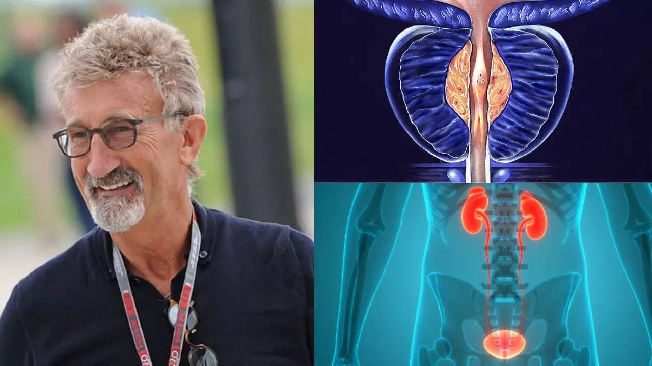 F1 Legend Eddie Jordan Reveals `Aggressive’ Prostate And Bladder Cancer; Know How To Catch Them Early  