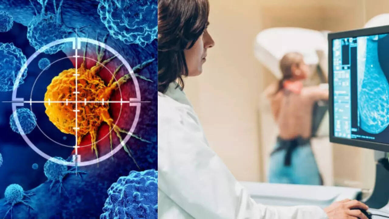 Top 5 Cancer Screenings That Should be on Your Radar in 2025  