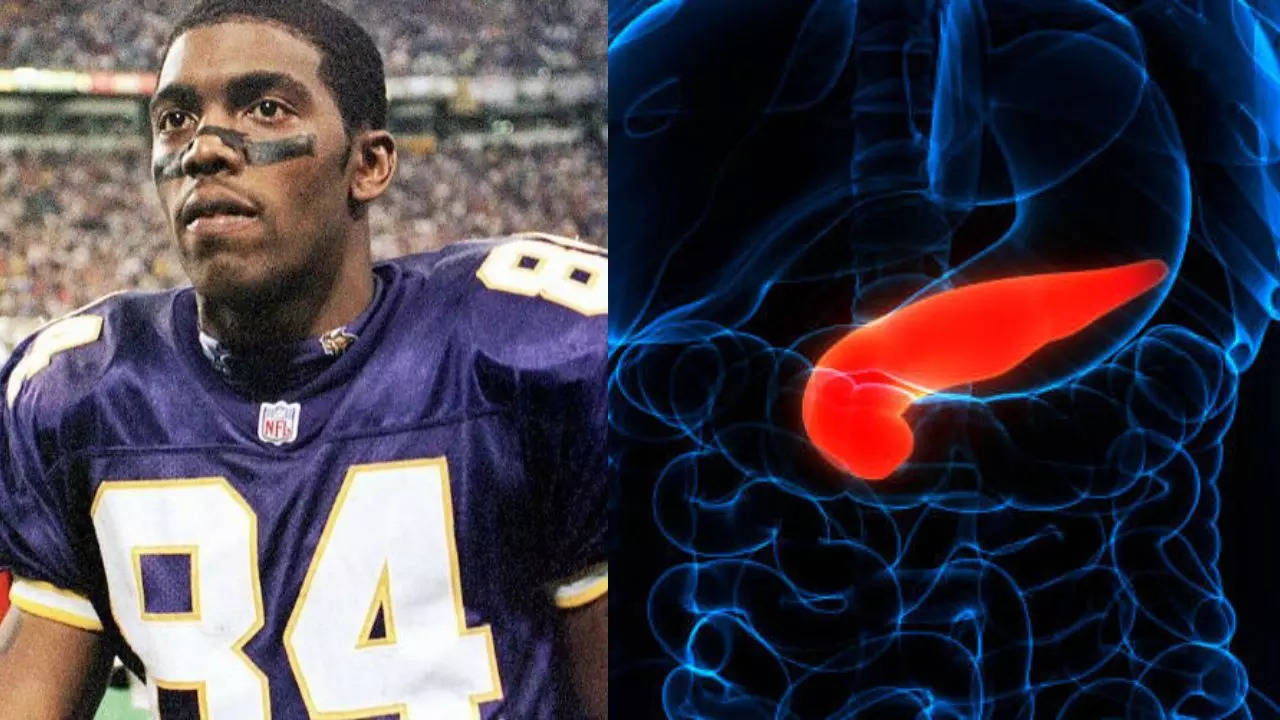 What Is Bile Duct Cancer American NFL Legend Randy Moss Is Battling