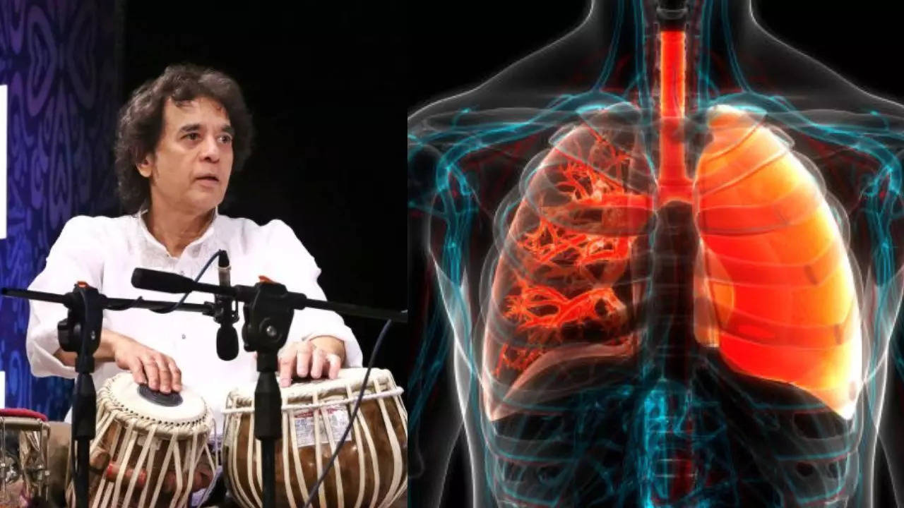 What is Idiopathic Pulmonary Fibrosis Ustad Zakir Hussain Died of