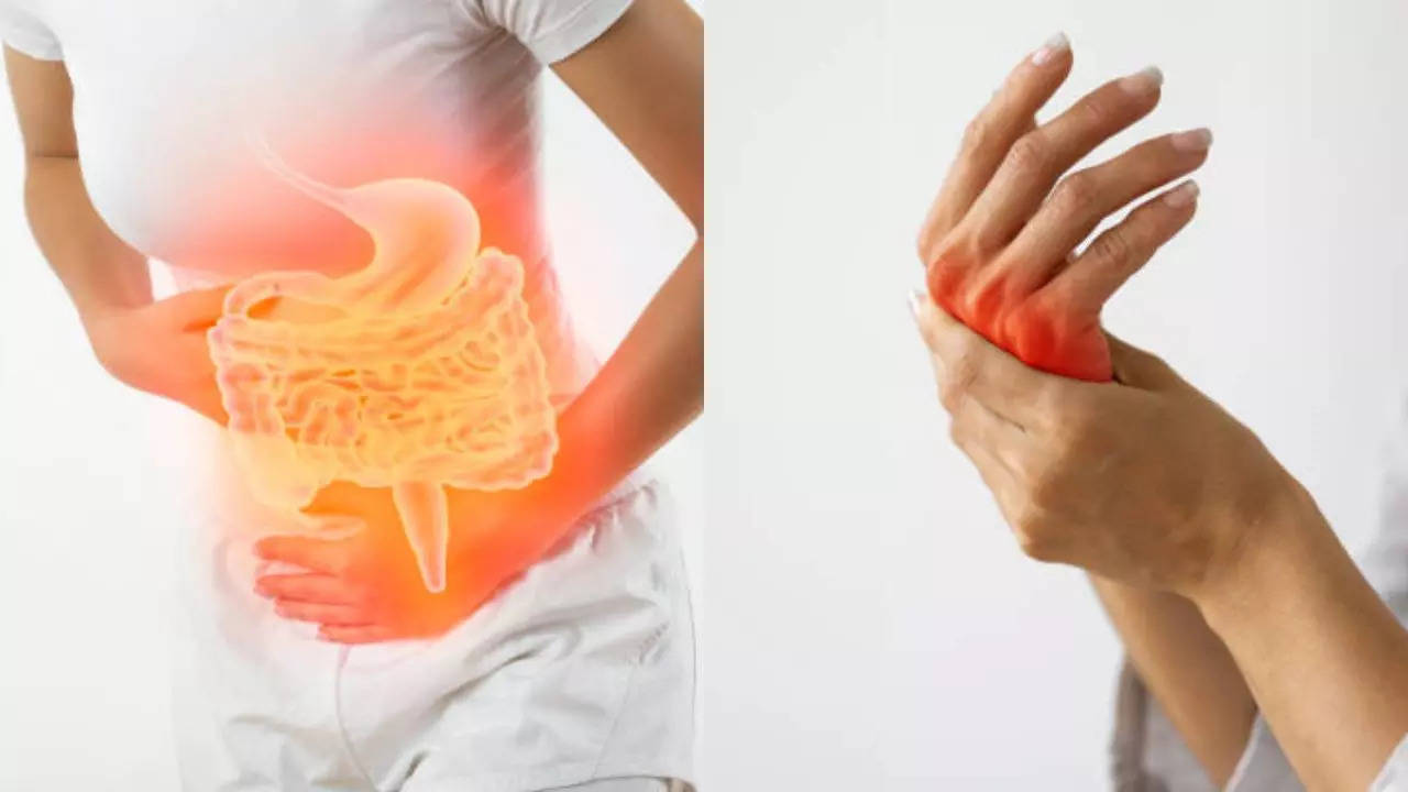 An Imbalanced Gut Triggers Painful Rheumatoid Arthritis