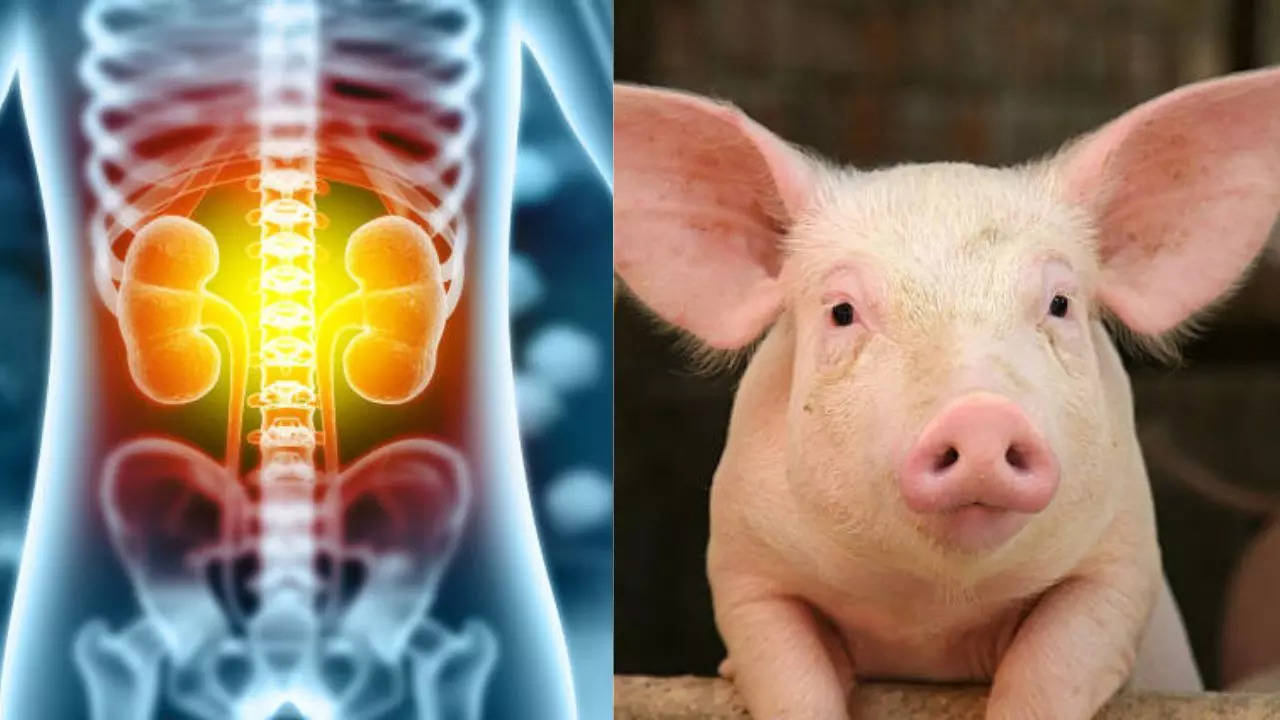 US Woman Living Healthy With Kidney Sourced From Pig 