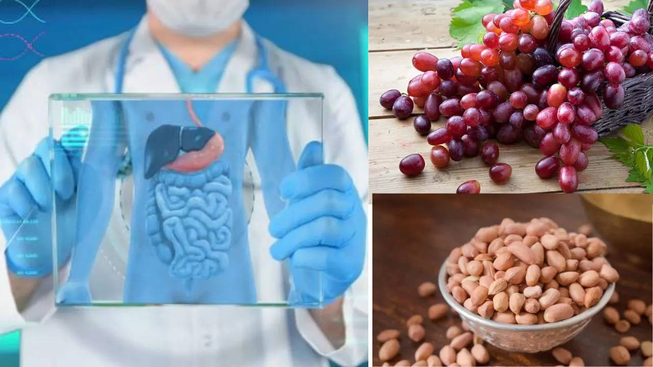 NHS Trial Sets To Identify Foods With “Miraculous” Ingredient That Can Prevent Bowel Cancer 