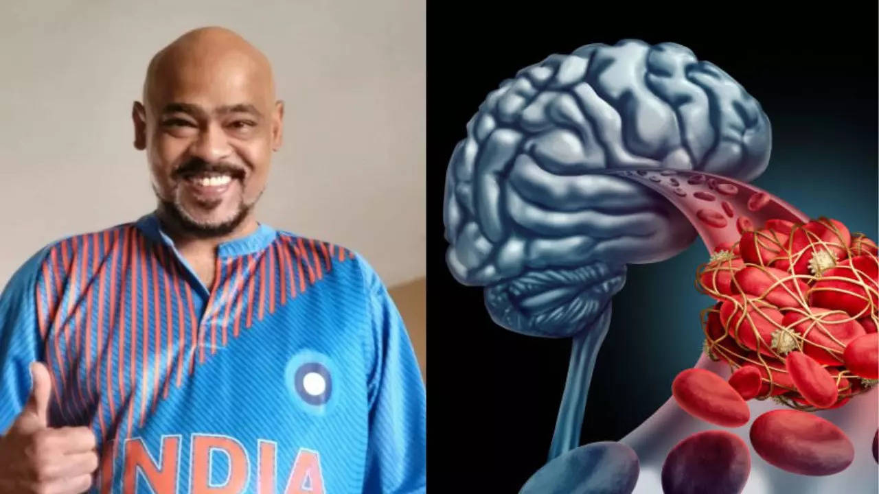 What Are Brain Clots Former Cricketer Vinod Kambli Has Been Diagnosed With