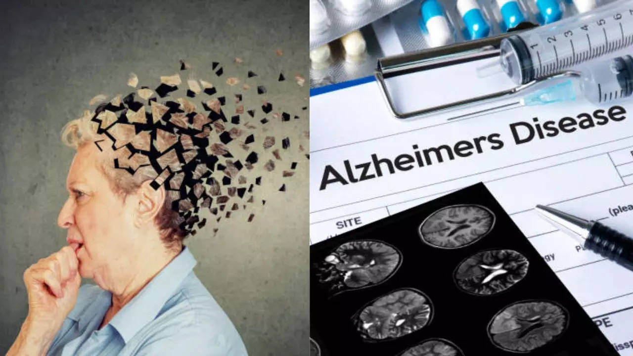 Breakthrough Research Paves the Way For Alzheimer’s Reversal Treatment; Here's How