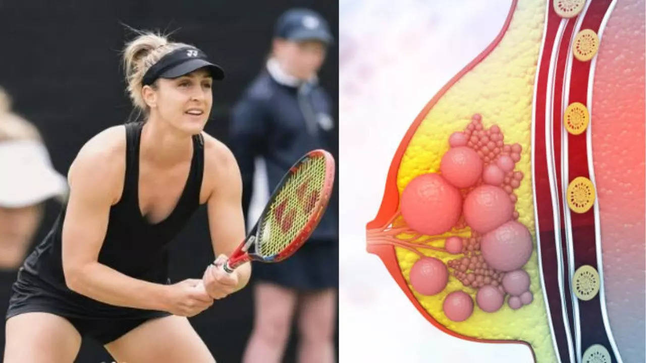 Wimbeldon Champion Gabriela Dabrowski Reveals Playing Matches Amid Breast Cancer Treatment; What Were Her Early Signs?