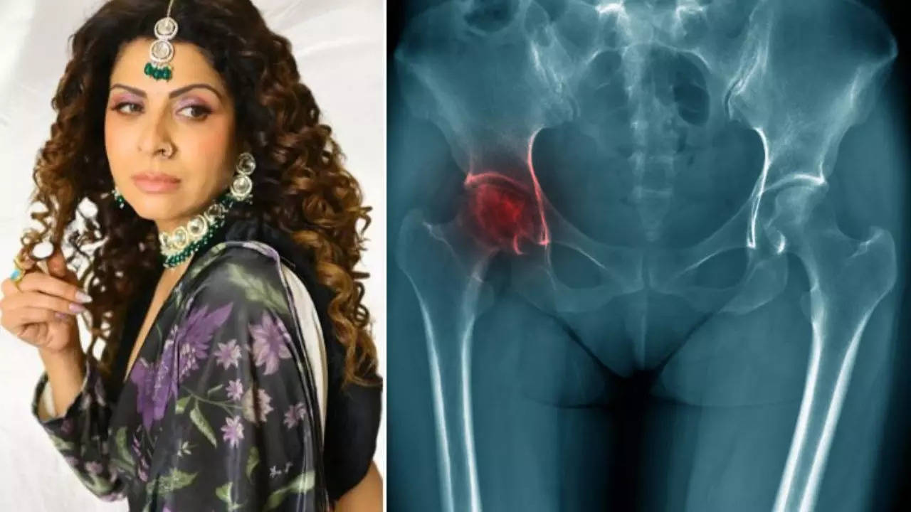 Tannaz Irani On Her Battle With Avascular Necrosis, Know All About The Life-Threatening Condition  