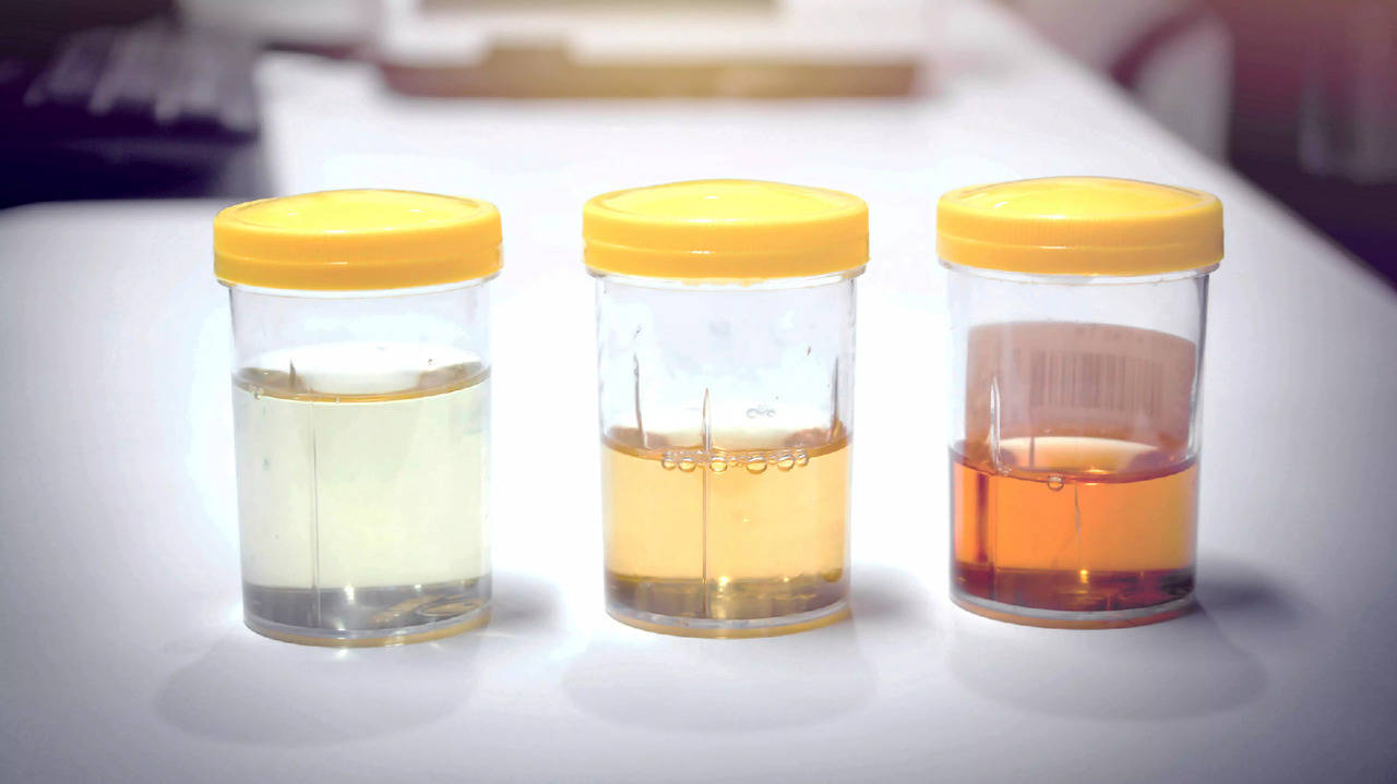 urine colour