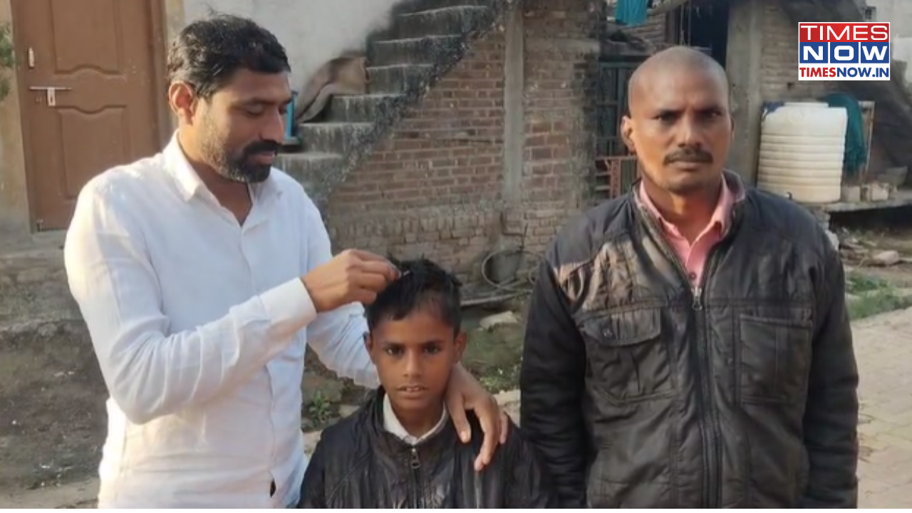 maharashtra shegaon turns ganja-gaon villagers suffer mass hair loss calamity, health department suspects this to be the reason