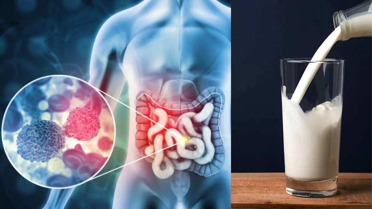 Do Not Ditch The Dairy, A Daily Glass of Milk Slashes The Risk of Bowel Cancer  