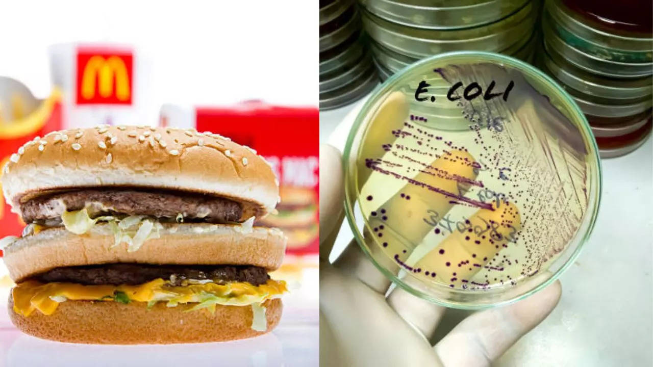 FDA says October E. coli outbreak at US McDonald’s caused by poor hand washing and dirty equipment; How deadly is bacteria?