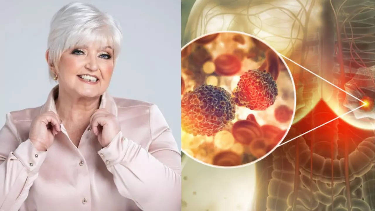 Breast cancer red flag signs you shouldn’t ignore after pop star Linda Nolan dies after battling the disease for 20 years