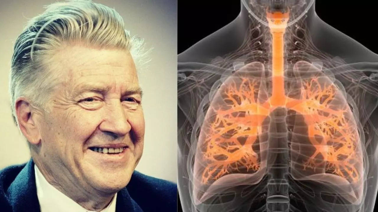 What Is Emphysema - A Chronic Lung Disease Which Doesn't Let You Breathe, David Lynch Had Due To Heavy Smoking