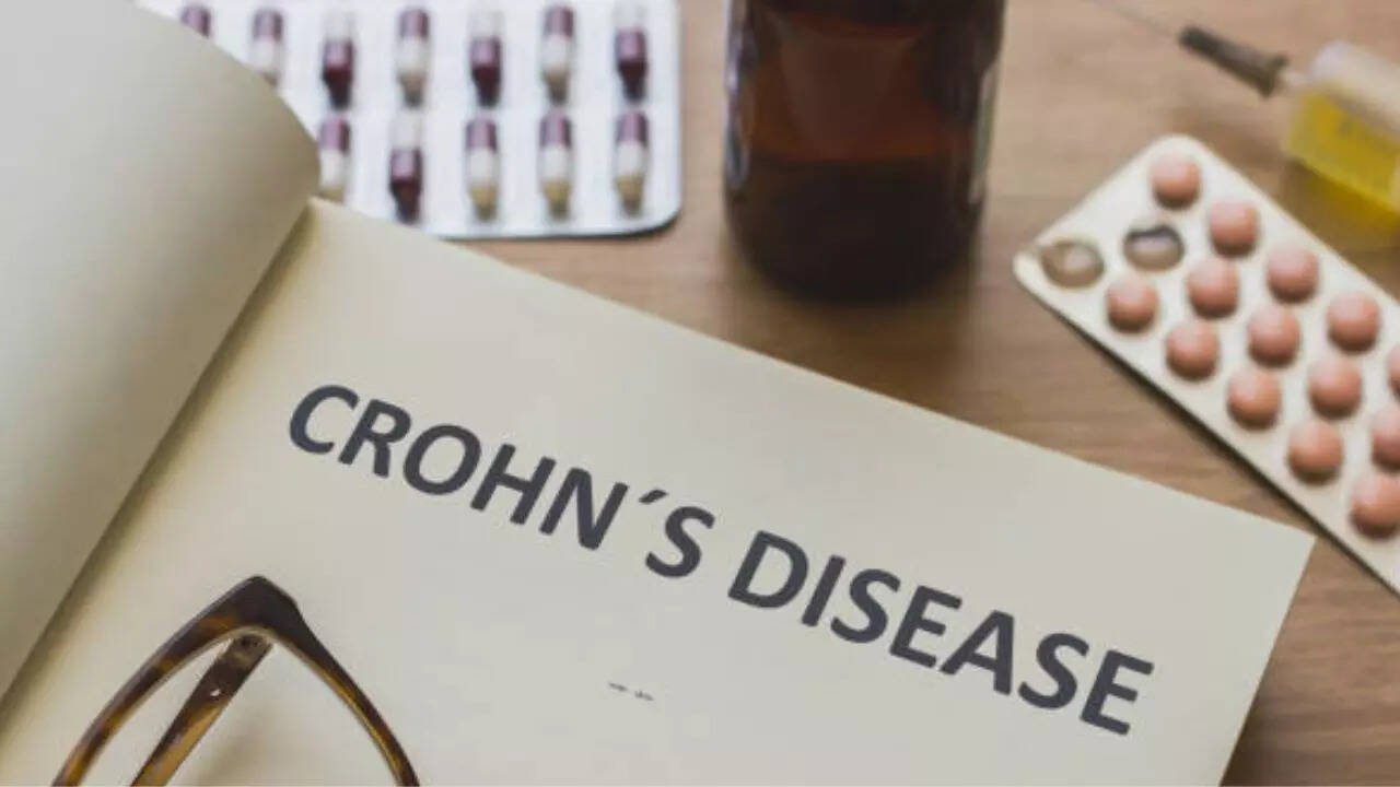 US FDA Approves Omvoh For Severe Crohn’s Disease Relief: All You Need To Know