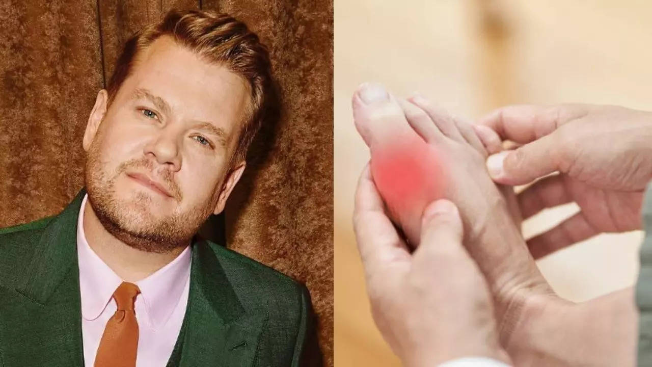 James Cordon Reveals Tudor Disease Diagnosis