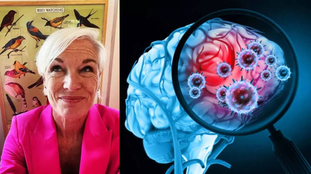 What is glioblastoma, an aggressive brain cancer that women’s rights activist Cecile Richards died of? Know the main symptoms