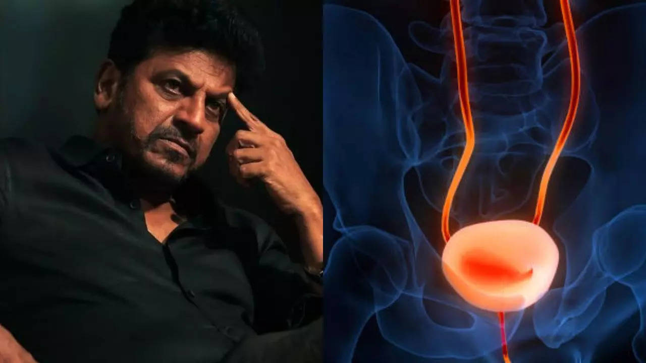 Shiva Rajkumar Cancer: What Is Bladder Cancer That Kannada Actor Shiva Rajkumar Had? Know the First Signs of This Silent Threat | Times Now