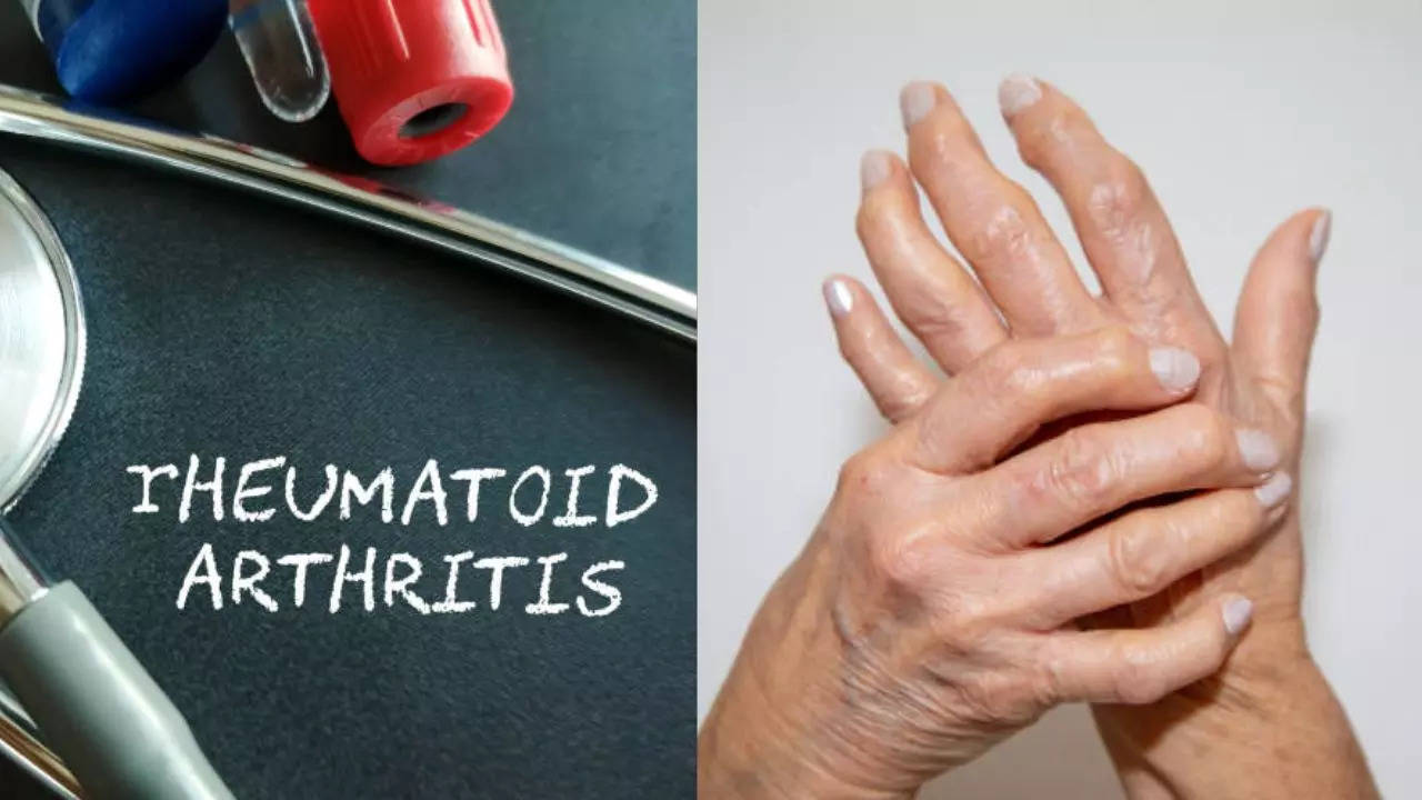 Morning hardness and unexpected weight loss? These symptoms may indicate rheumatism