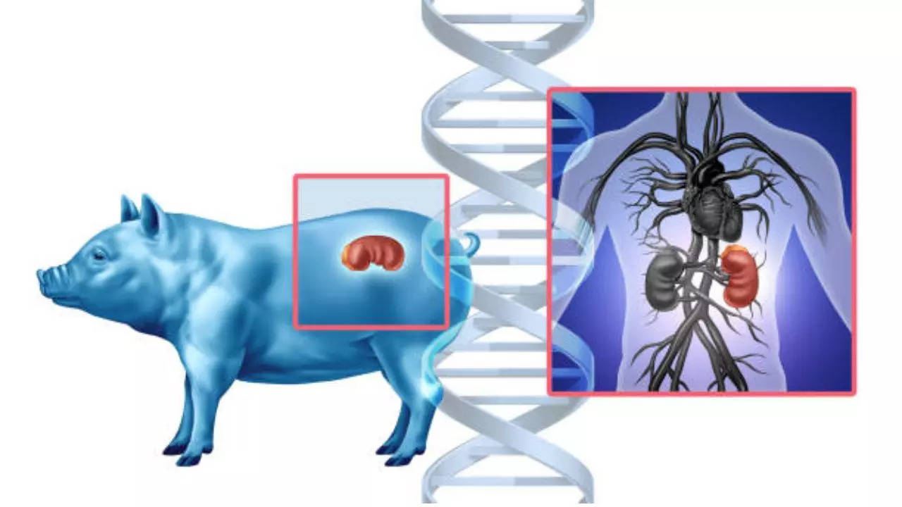 FDA approves clinical trials for pig kidney transplant in humans