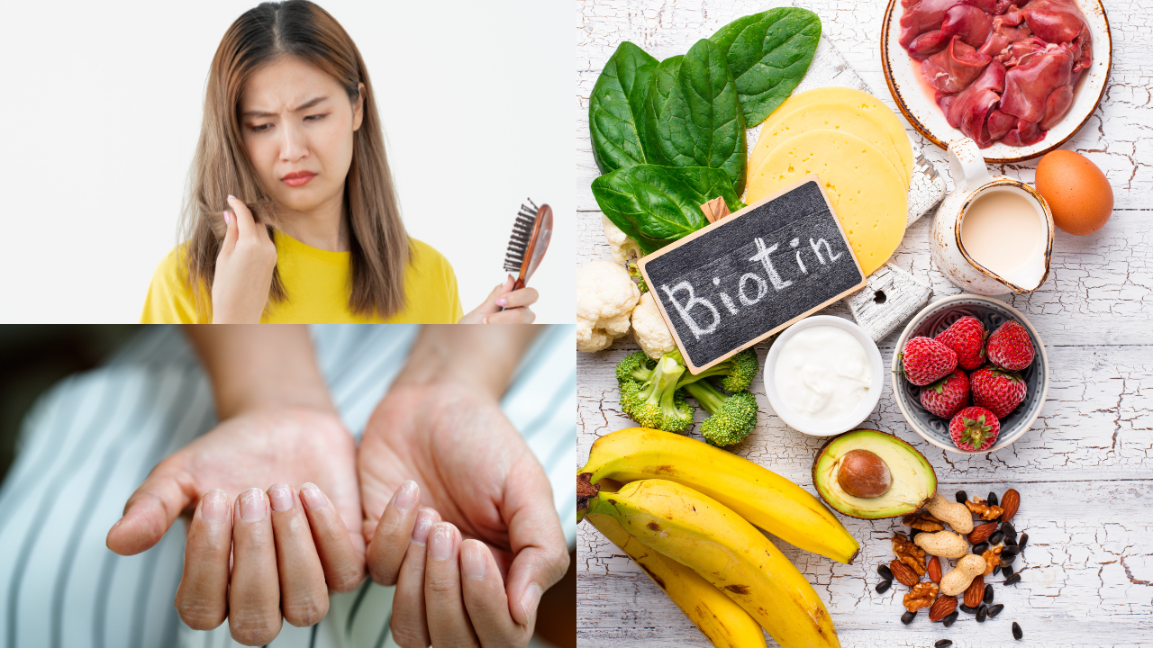 Biotin to prevent: Eat your way to strengthen hair and nails