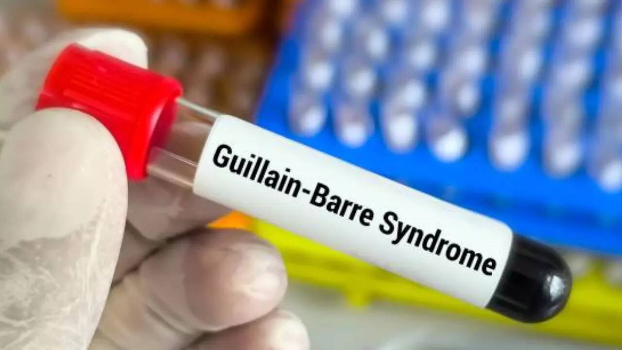 guillain-barre syndrome: maharashtra reports 140 cases, 1 death and 5 suspected fatalities