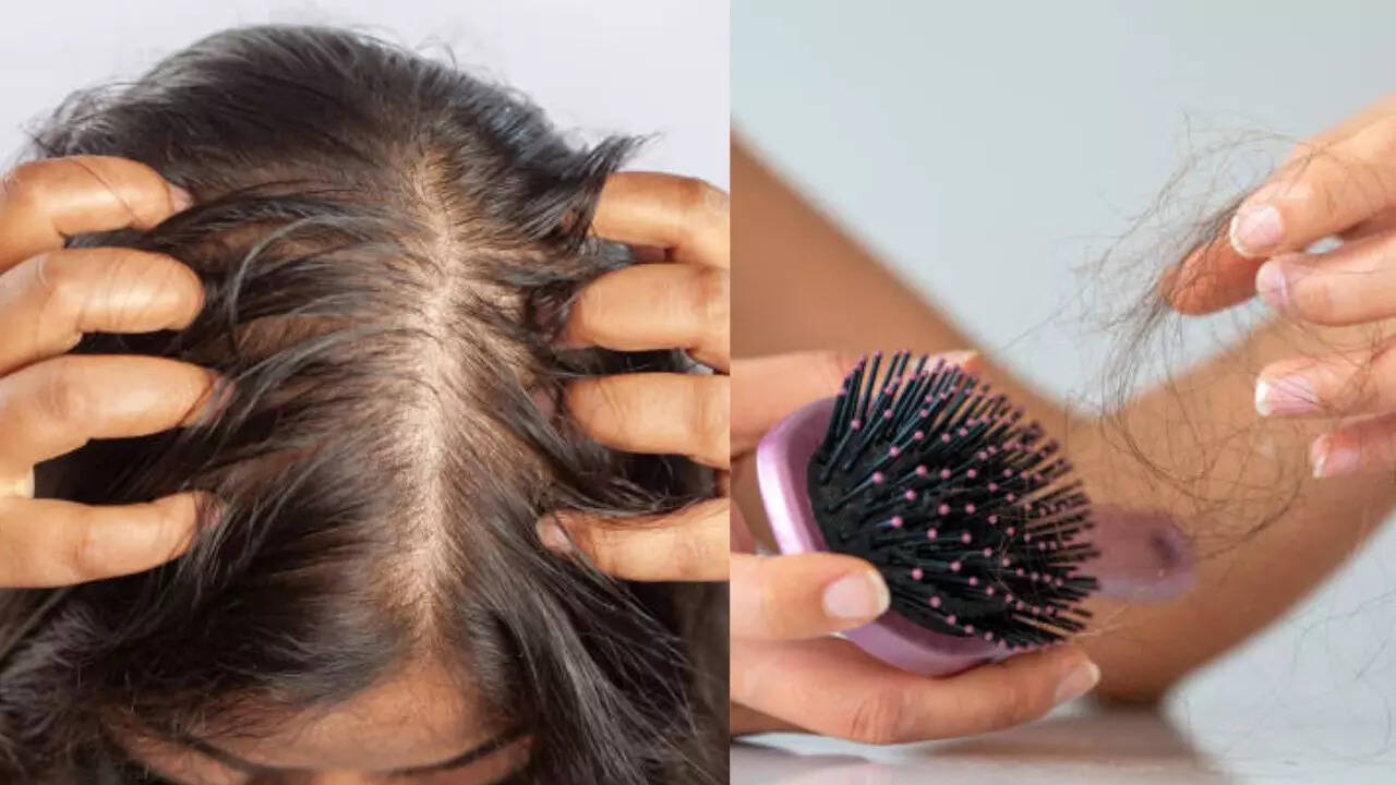 your hairfall might not be normal—these signs indicate a hormonal disaster!