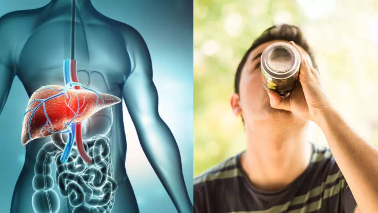 Alcohol -related liver cirrhosis kills about 300 teenagers in Goa; Learn about the disease that cannot be reversed Alcohol -related liver cirrhosis kills about 300 teenagers in Goa; Learn about the disease that cannot be reversed