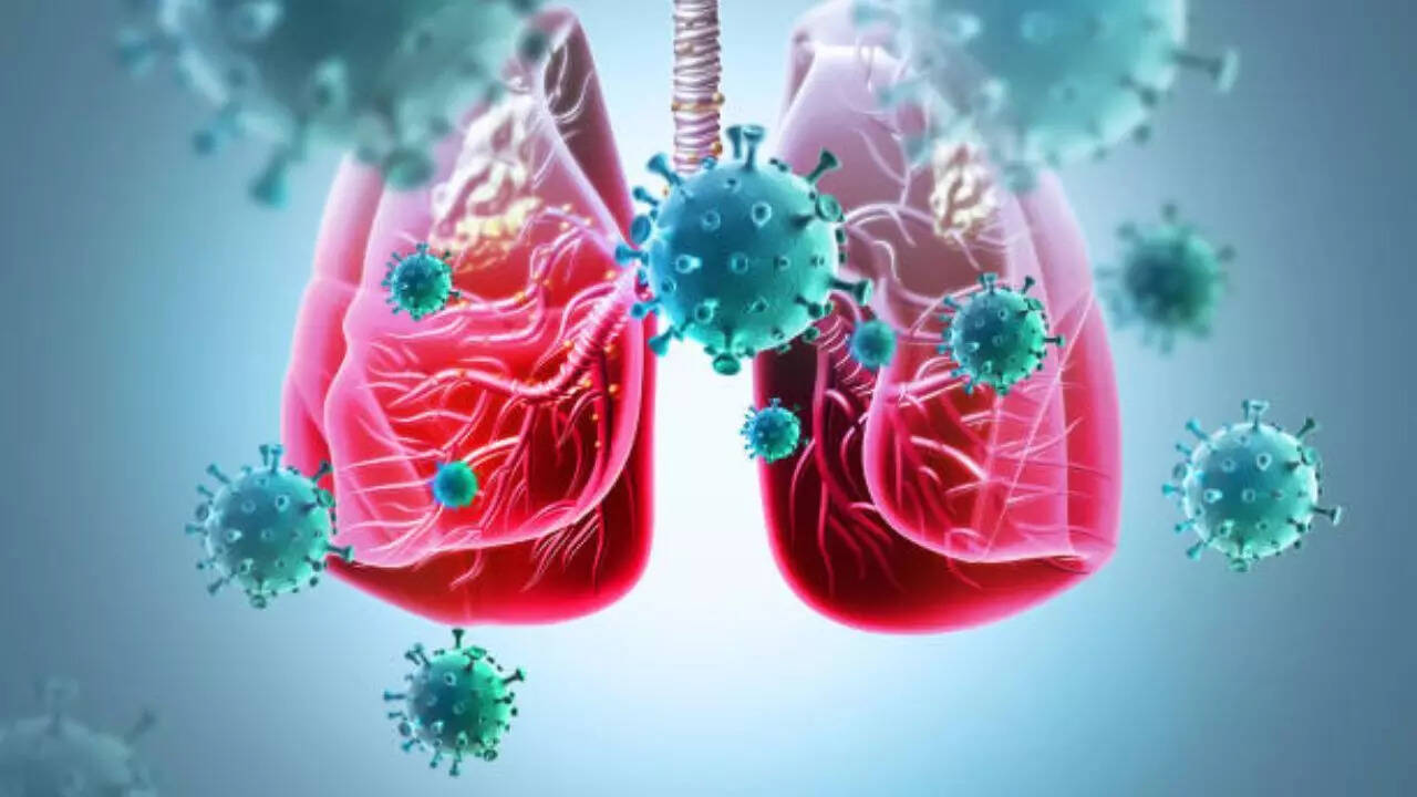 World Health Organization warns of potential increase in tuberculosis cases due to USAID cut World Health Organization warns of potential increase in tuberculosis cases due to USAID cut