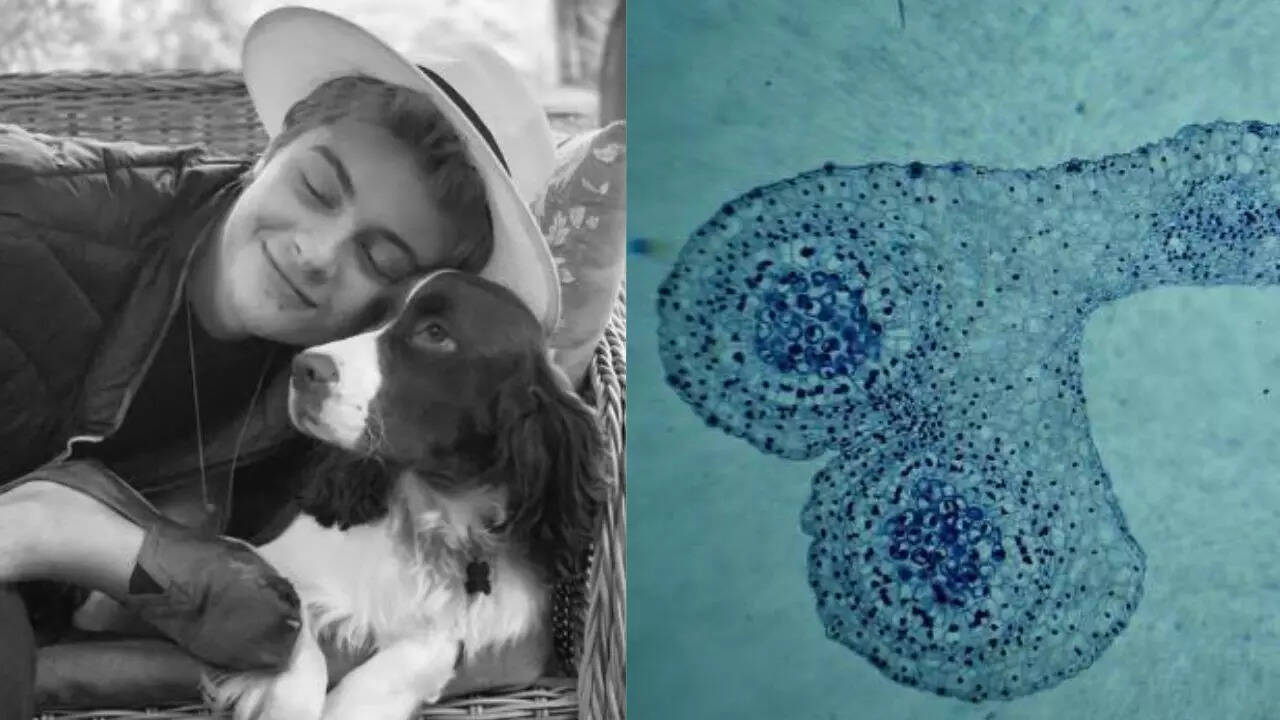 What is the Polyg Mitochondrial Disease that Rajkumar Frederick of Luxembourg was 22 years old? What is the Polyg Mitochondrial Disease that Rajkumar Frederick of Luxembourg was 22 years old?
