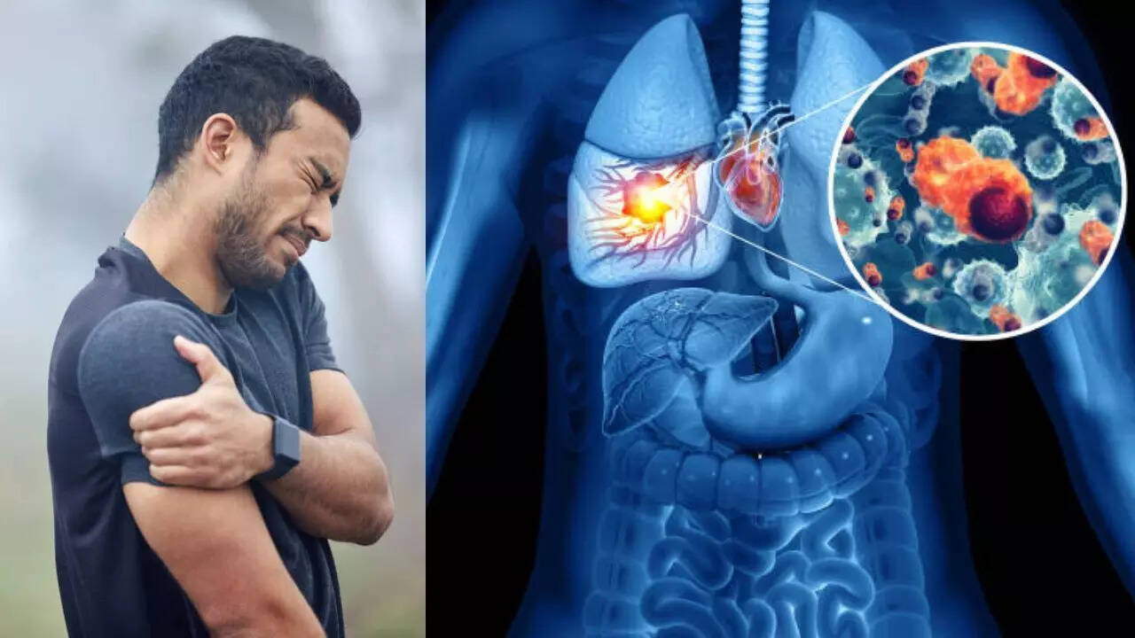 Silence symptoms of lung cancer