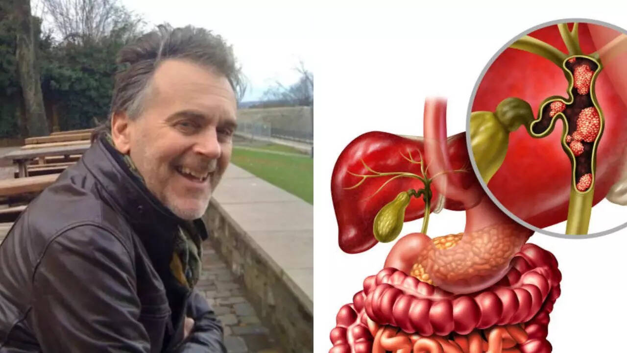 A few weeks after bile rare duct cancer diagnosis, fit and healthy lawyer dies; Initial symptoms you should not ignore A few weeks after bile rare duct cancer diagnosis, fit and healthy lawyer dies; Initial symptoms you should not ignore