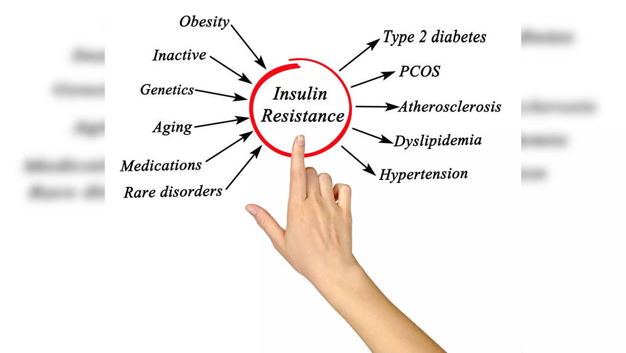 PCOS Overweight obesity diabetes blood sugae PCOD weight loss