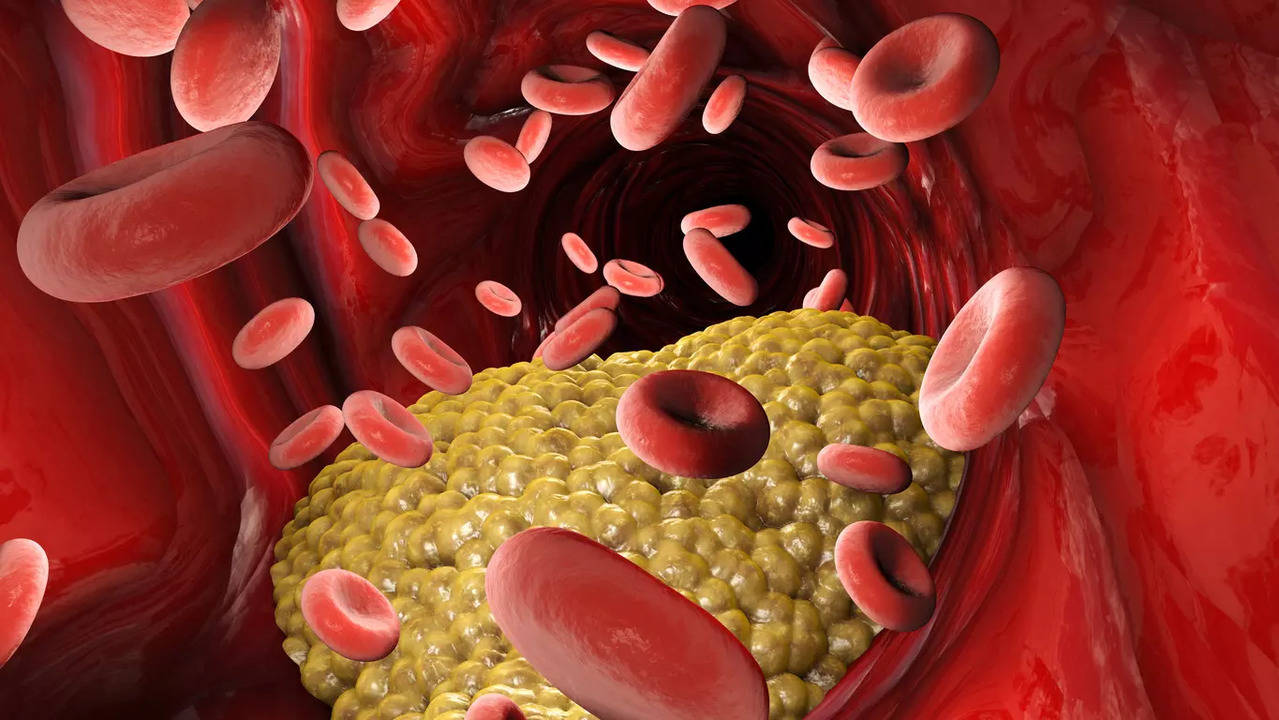 High cholesterol: Easy to make drinks to manage lipid profile