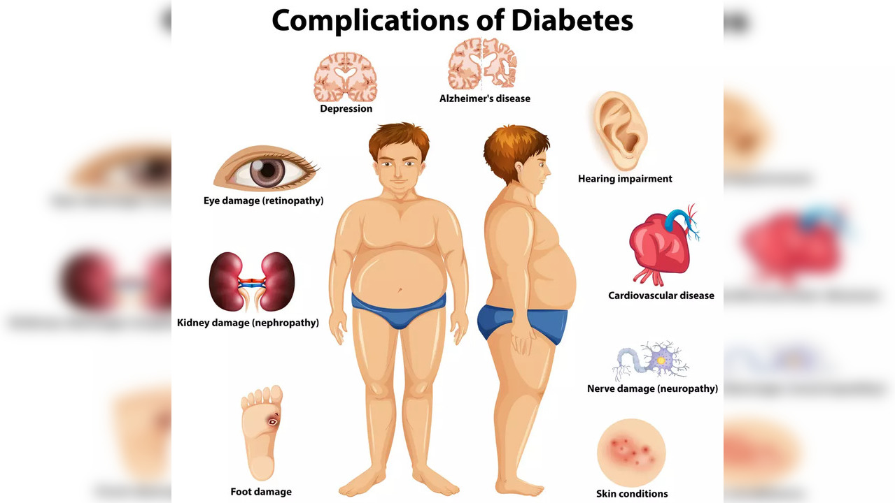 Diabetes fallout organ damage