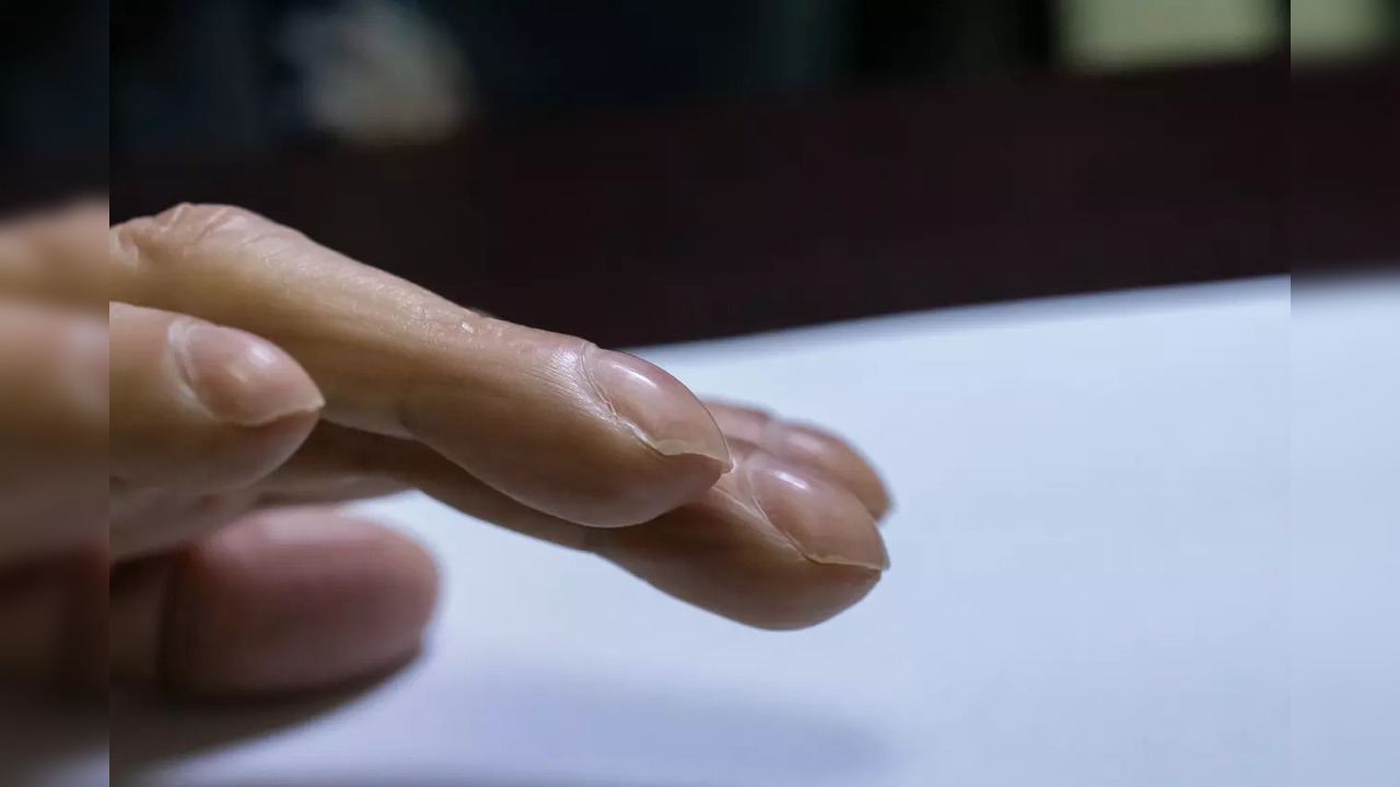 THIS is how lung cancer symptoms can show up on your fingernails UK