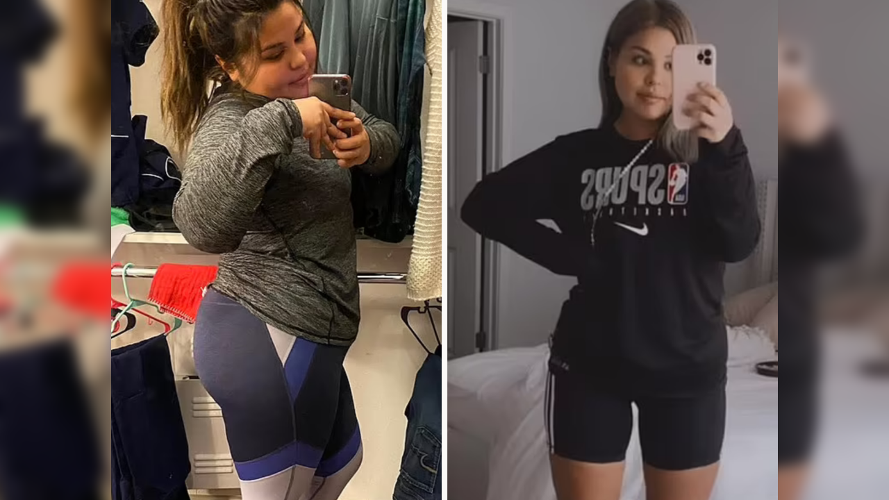 Woman finds 10 kg tumour with teeth and hair growing inside her ovary