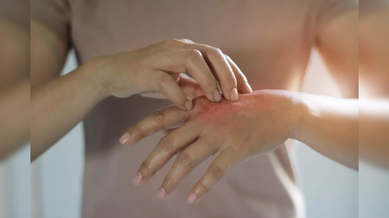 Skin health: Know about 5 most common disorders and their symptoms